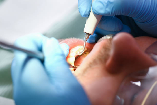 Best Urgent Tooth Repair  in Clearfield, UT
